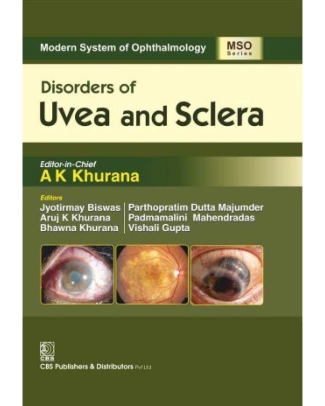 Disorders of Uvea and Sclera