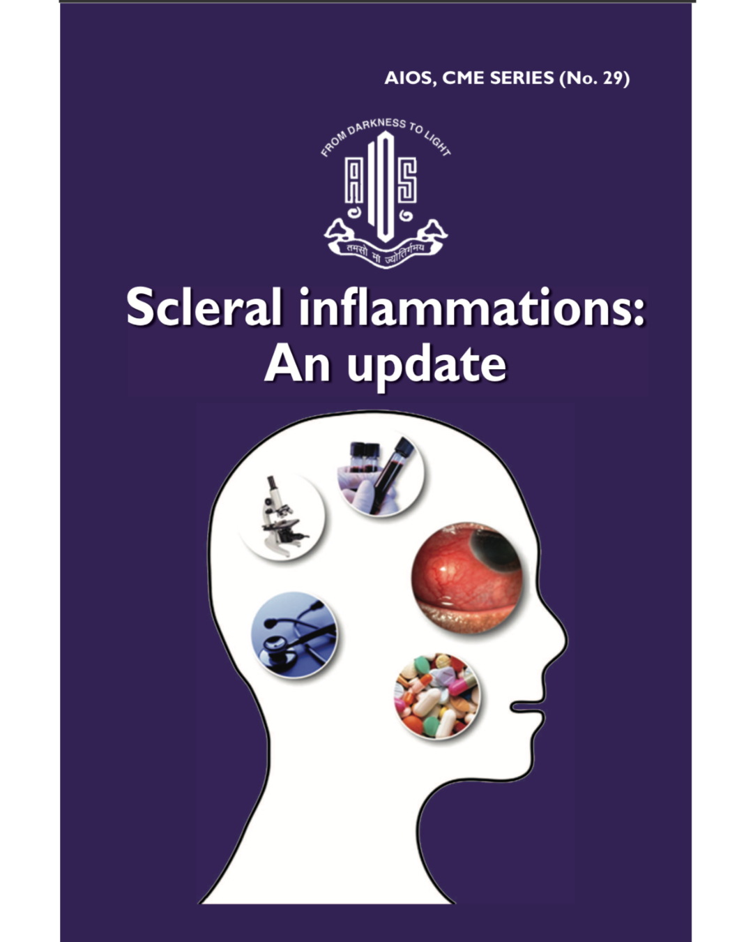 Scleral Inflammations An Update