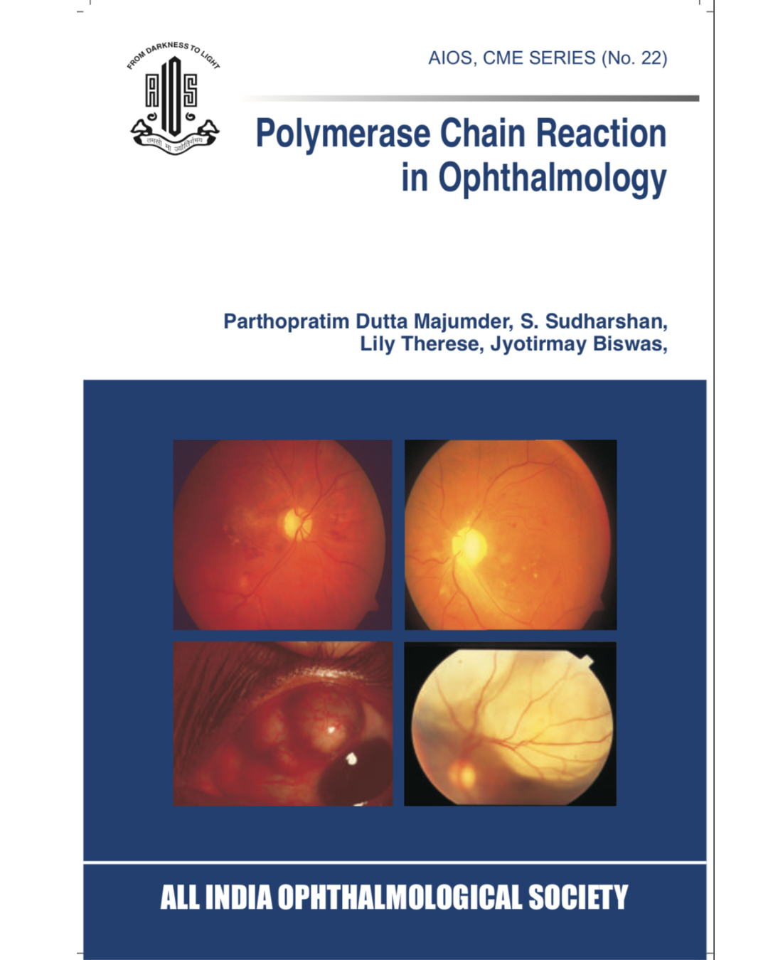Polymerase Chain Reaction in Ophthalmology