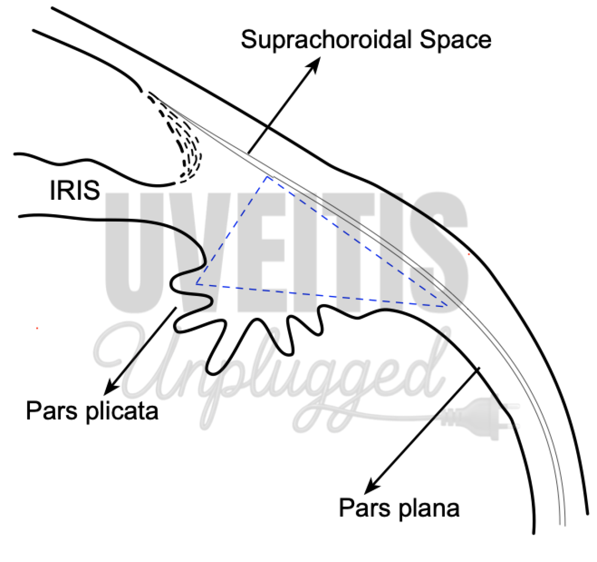 Anatomy of Uveal Tract: Ciliary body